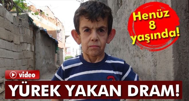 ?Erken yaşlanma hastalığına´ yakalanan çocuğun yürek yakan dramı