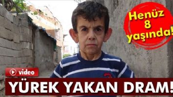 ?Erken yaşlanma hastalığına´ yakalanan çocuğun yürek yakan dramı